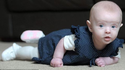 Chuyện ly kỳ về bé gái “ma trắng”