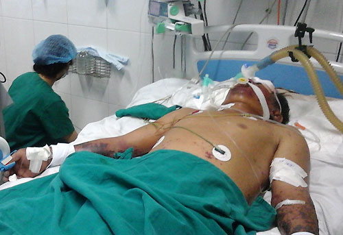 Cảnh báo tử vong do nhiễm khuẩn liên cầu lợn gia tăng dịp Tết