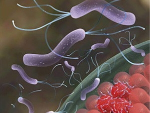 Vi khuẩn Helicobacter Pylori giúp ngăn bệnh suyễn