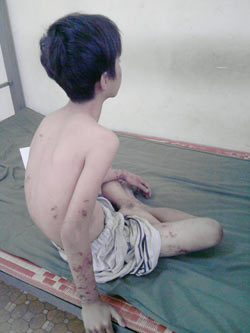 Đắc Lắc: Khởi tố, bắt tạm giam người cha dùng lửa đốt con