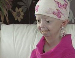 Tìm ra thuốc chữa bệnh già trước tuổi