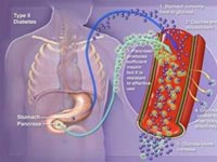 Sẽ khống chế các bệnh nan y